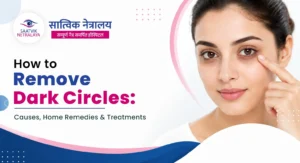 How to Remove Dark Circles